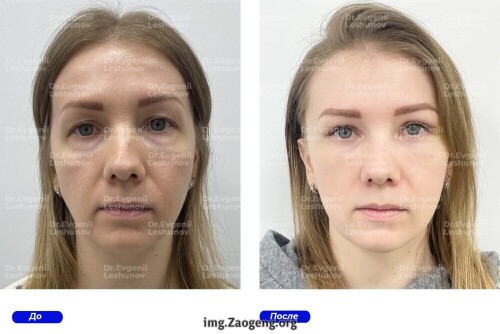 intimateplasty.ru.jpg